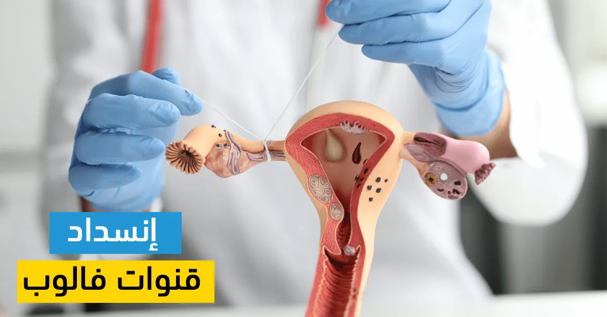 إنسداد قنوات فالوب